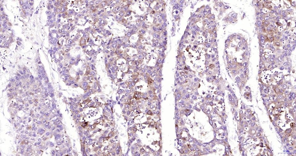 Anti-NFE2L2 Polyclonal Antibody