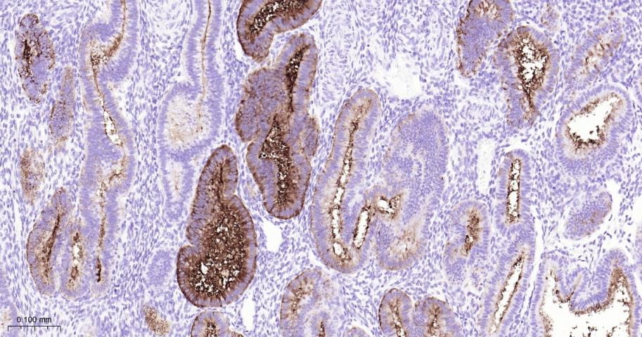 Anti-Mucin-16/MUC16 Antibody (8O689)