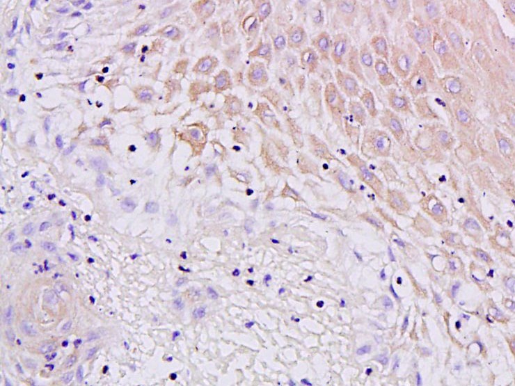 Anti-Mucin-4/MUC4 Polyclonal Antibody