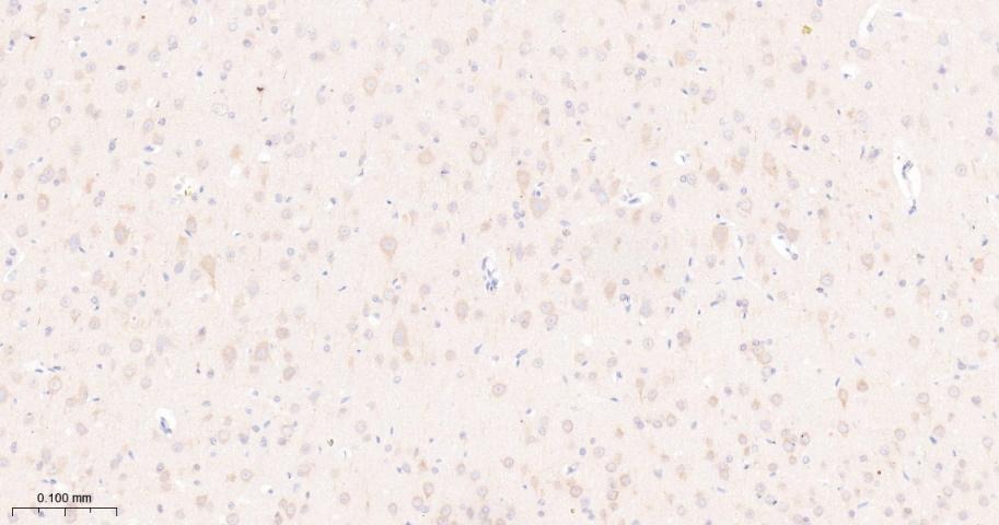 Anti-mTOR Antibody (2K378)