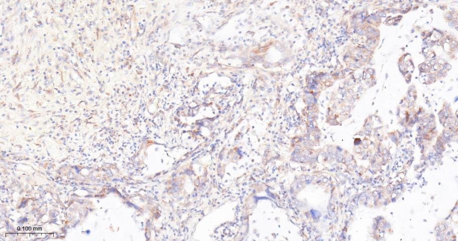 Anti-mTOR Antibody (2K378)