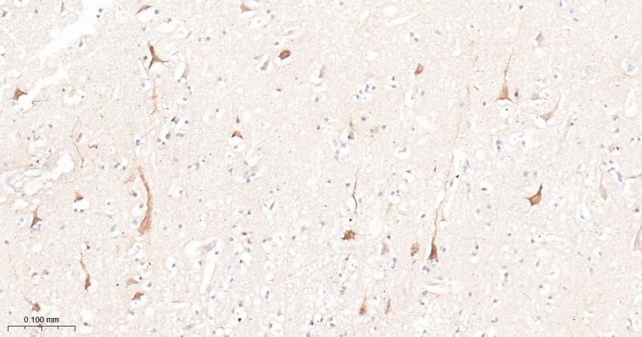 Anti-mTOR Antibody (2K378)