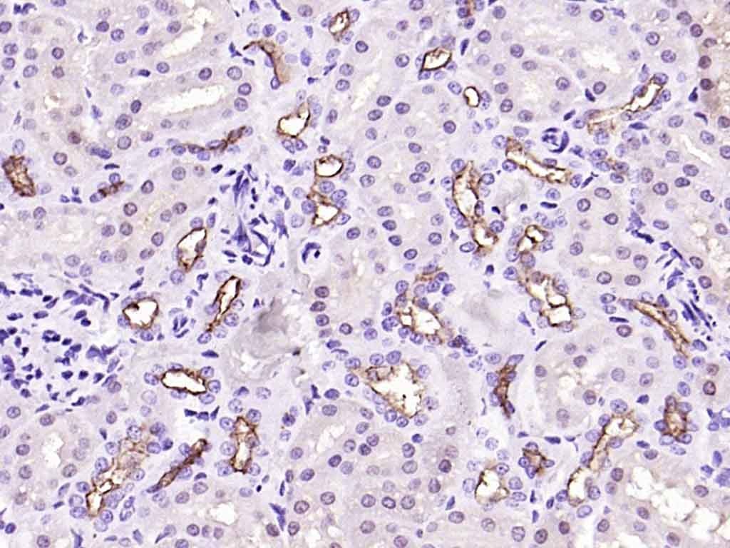 Anti-Mucin-1/MUC1 Polyclonal Antibody