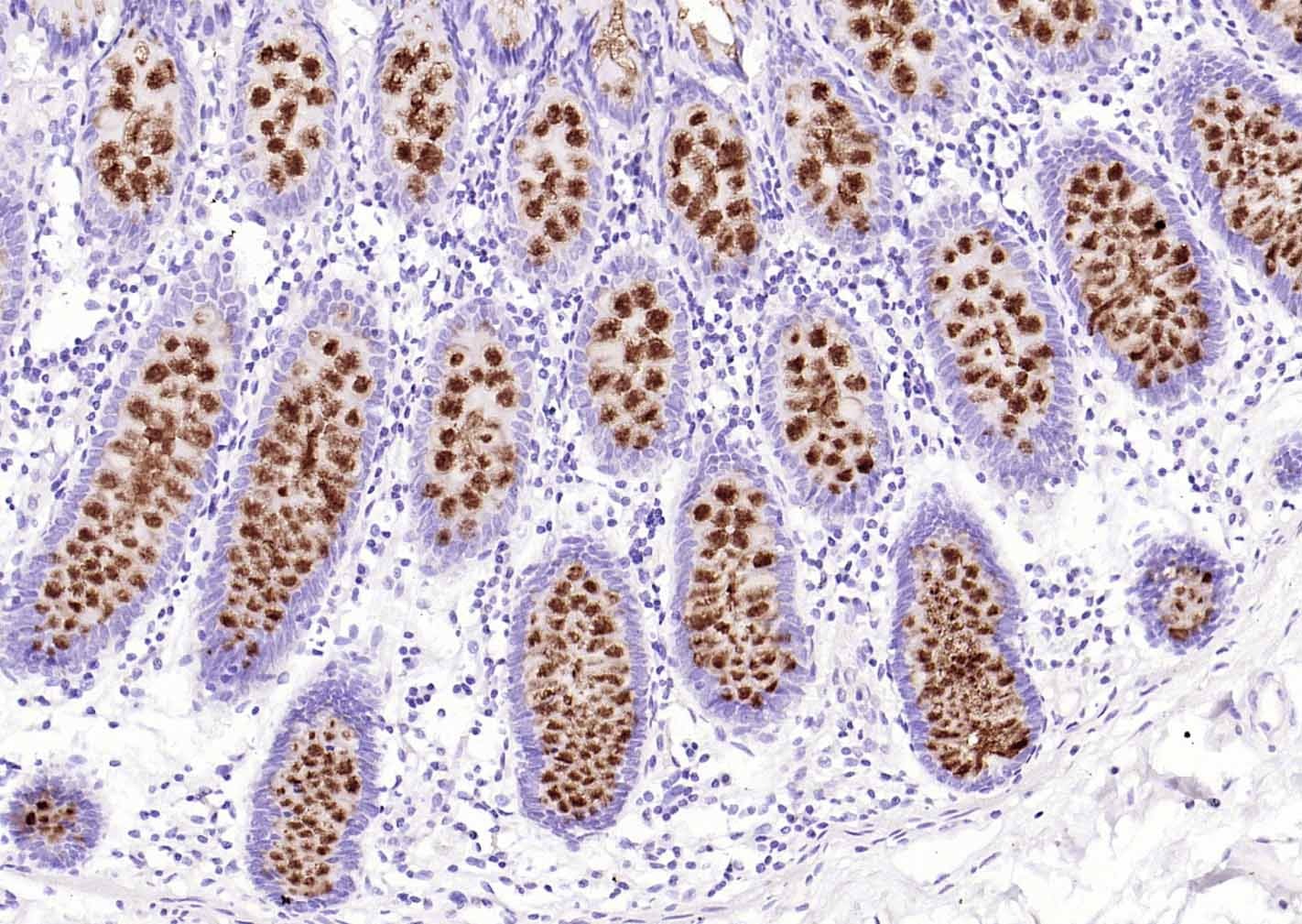 Anti-Mucin-2/MUC2 Antibody (1B747)