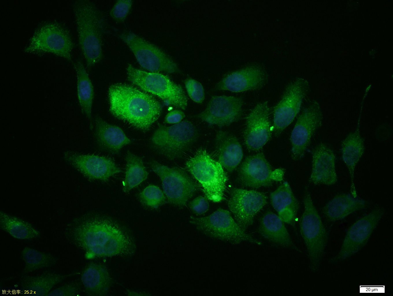 Anti-Mucin-1/MUC1 Polyclonal Antibody