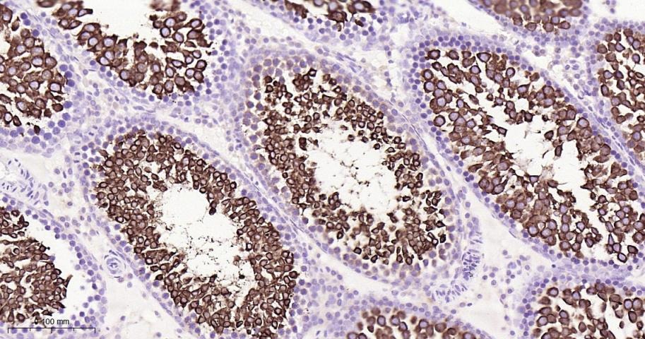 Anti-NFE2L2 Polyclonal Antibody