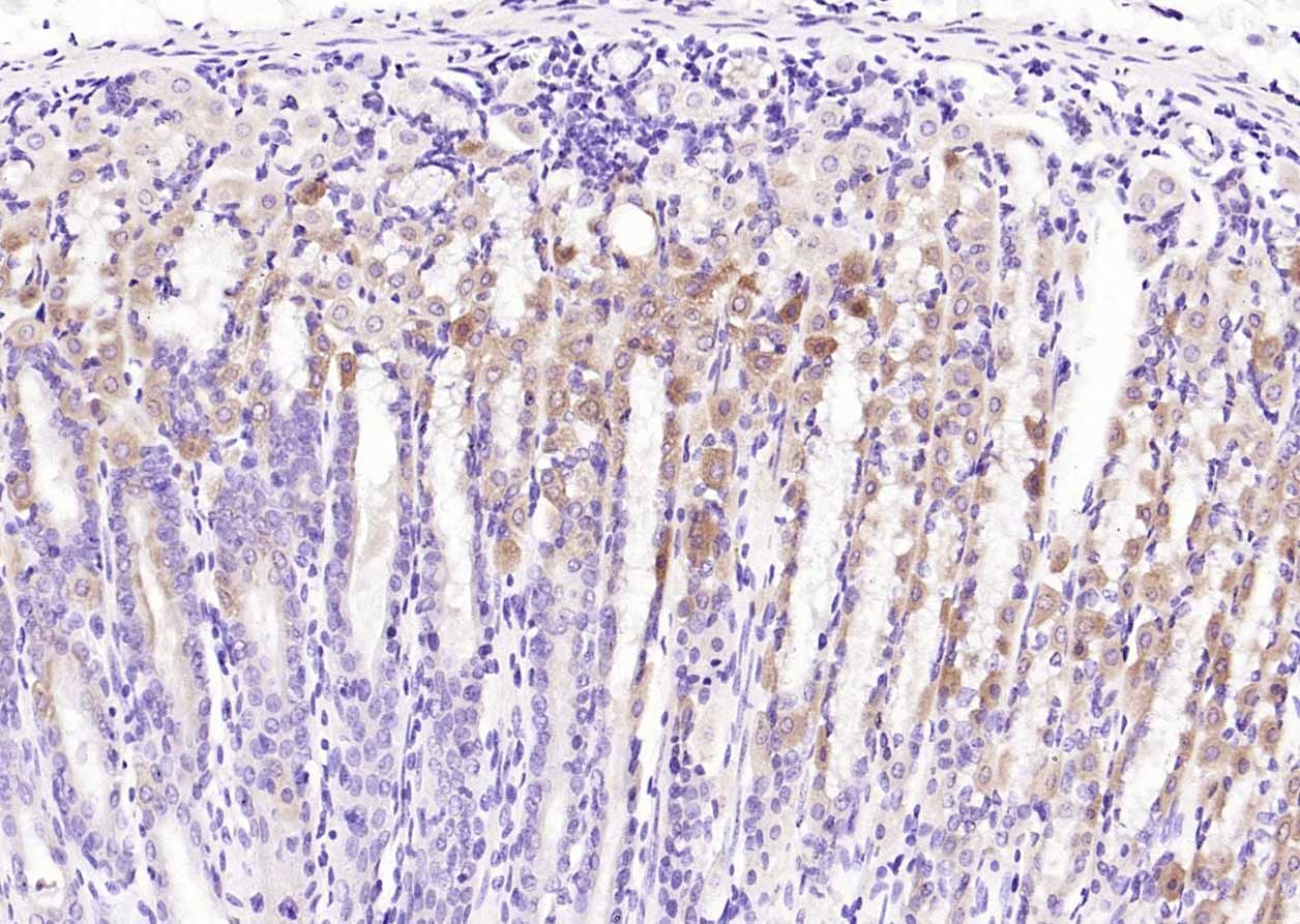 Anti-Phospho-SMAD7 (Ser249) Polyclonal Antibody