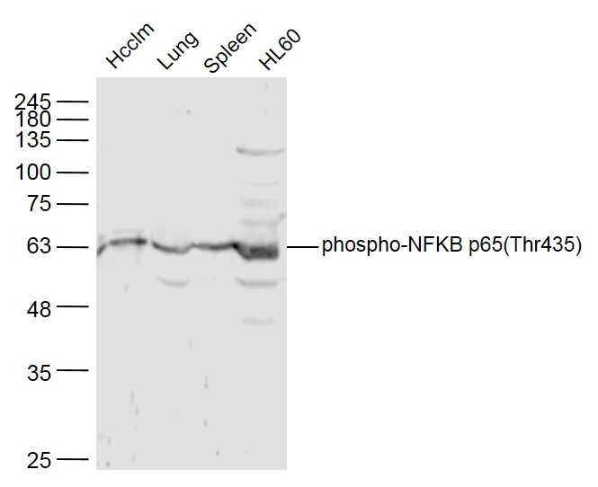 Anti-Phospho-NF-kB p65 (Thr435) Polyclonal Antibody