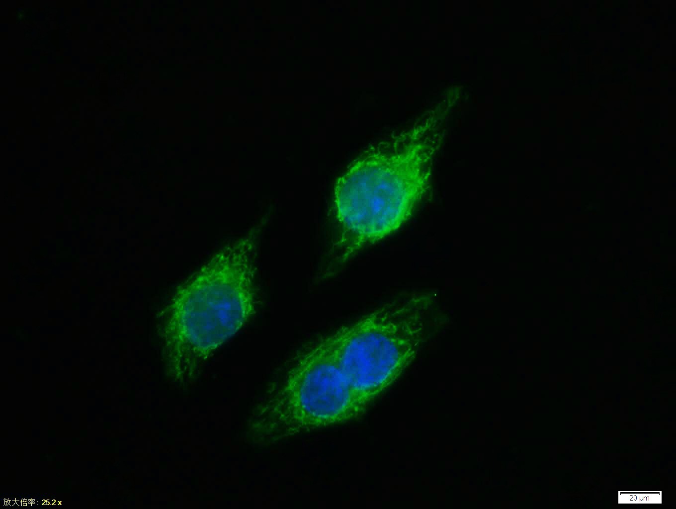 Anti-Phospho-NF-kB p65 (Thr435) Polyclonal Antibody