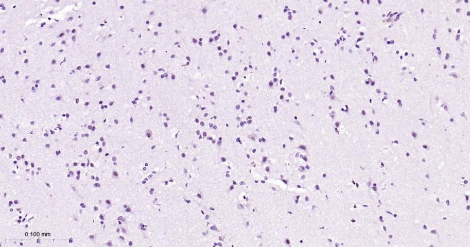 Anti-Phospho-STAT3 (Tyr705) Antibody (2J657)