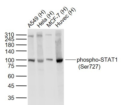 Anti-Phospho-STAT1 (Ser727) Antibody (4T516)