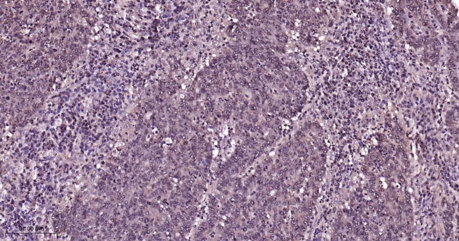 Anti-Phospho-p38 MAPK (Thr180, Tyr182) Polyclonal Antibody