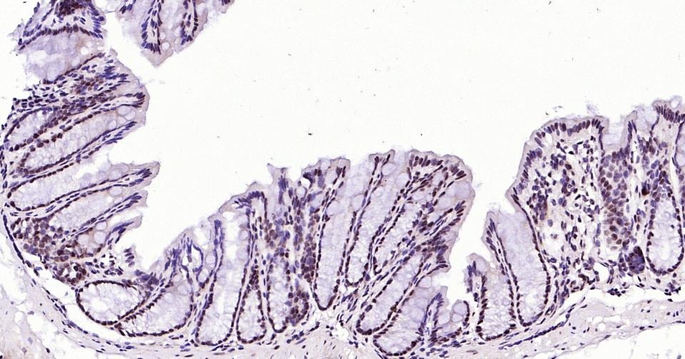 Anti-Phospho-STAT3 (Ser727) Antibody (8J881)