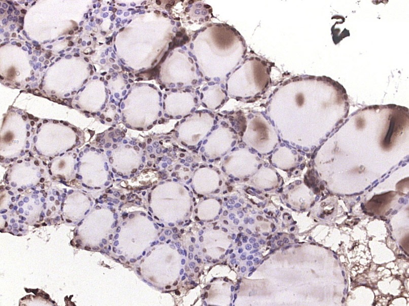 Anti-Phospho-p38 MAPK (Tyr323) Polyclonal Antibody