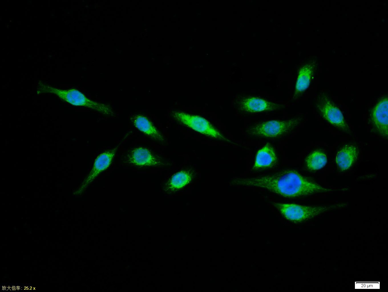 Anti-Phospho-NF-kB p65 (Thr435) Polyclonal Antibody