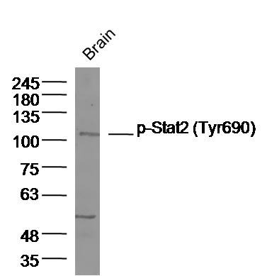Anti-Phospho-STAT2 (Tyr690) Polyclonal Antibody
