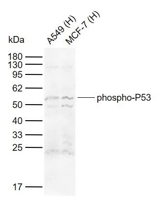 Anti-Phospho-p53 (Ser15) Polyclonal Antibody