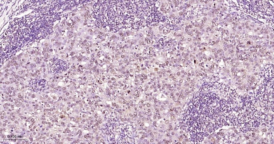 Anti-Phospho-STAT3 (Tyr705) Antibody (2J657)