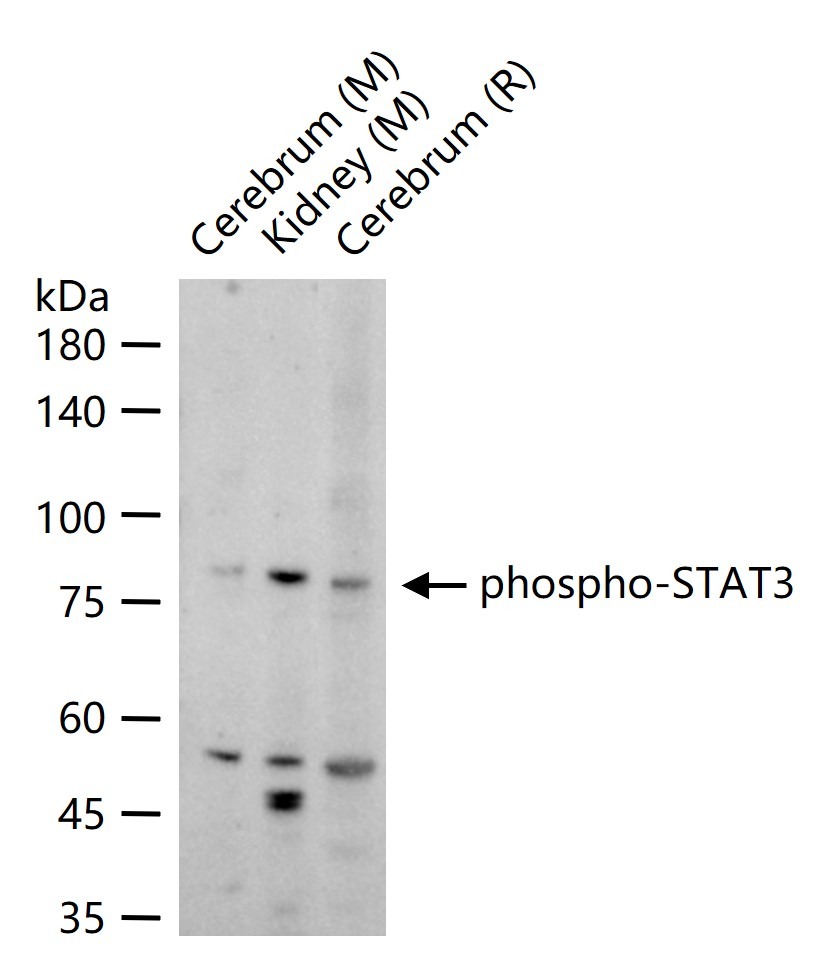 Anti-Phospho-STAT3 (Tyr705) Polyclonal Antibody