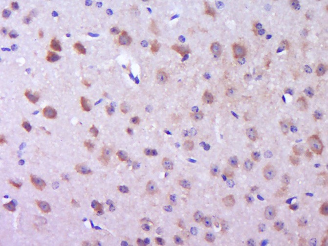 Anti-Phospho-P38 MAPK (Thr180) Polyclonal Antibody