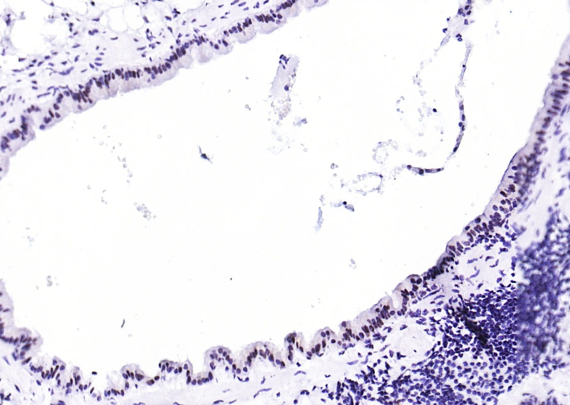 Anti-Phospho-STAT1 (Ser727) Antibody (4T516)