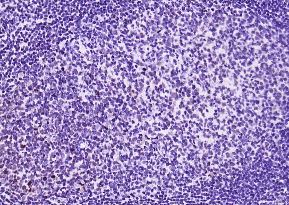 Anti-Phospho-STAT1 (Ser727) Antibody (4T516)