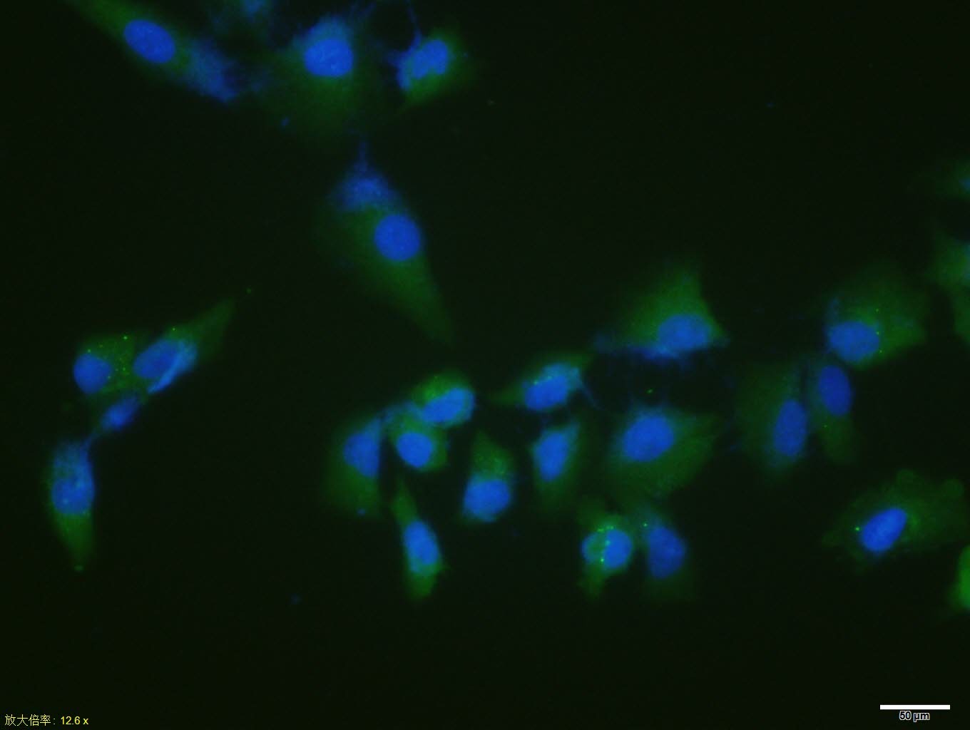 Anti-Phospho-p53 (Ser15) Polyclonal Antibody