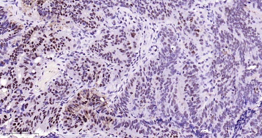 Anti-Phospho-STAT3 (Tyr705) Antibody (2J657)