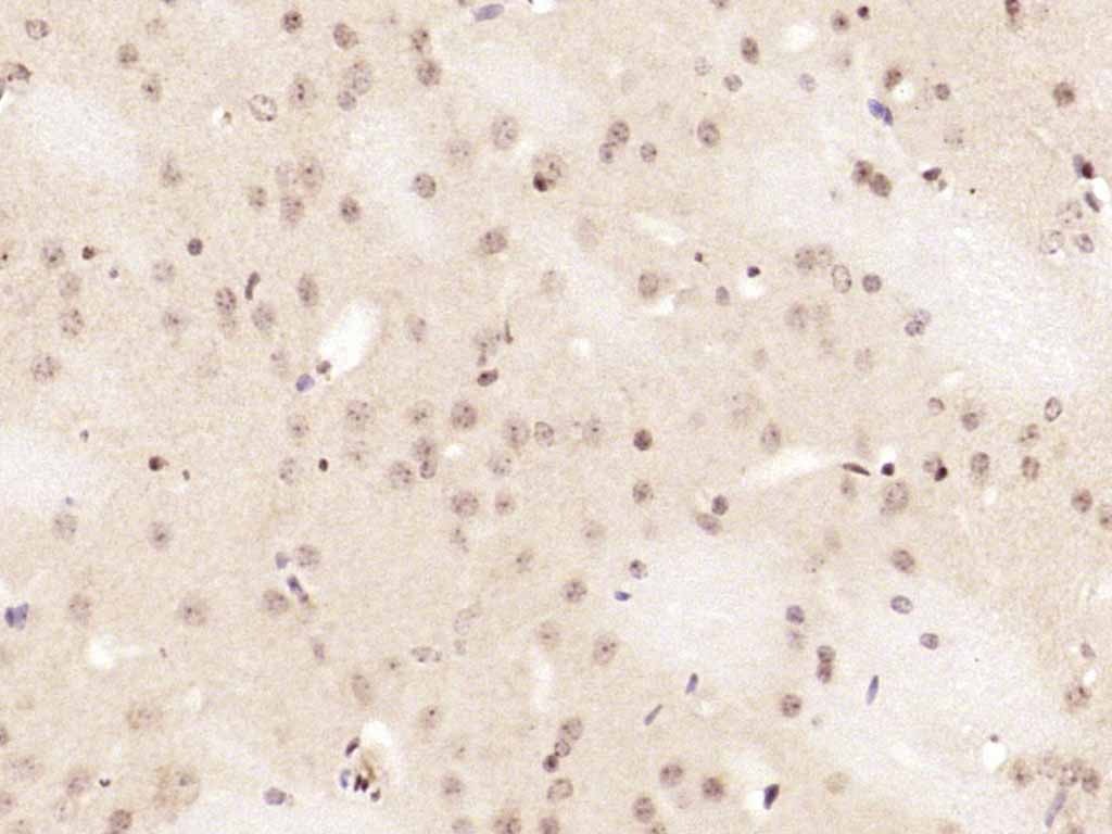 Anti-Phospho-NFKB1 (Ser337) Polyclonal Antibody