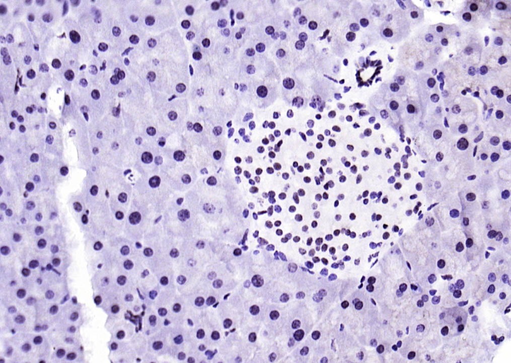 Anti-Phospho-STAT1 (Ser727) Antibody (4T516)