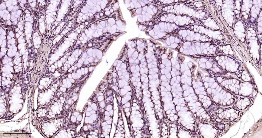 Anti-Phospho-p38 MAPK (Thr180, Tyr182) Polyclonal Antibody