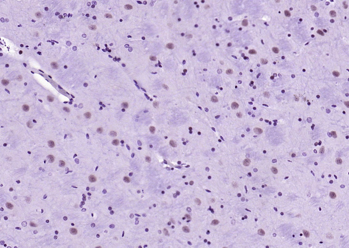 Anti-Phospho-STAT1 (Ser727) Antibody (4T516)