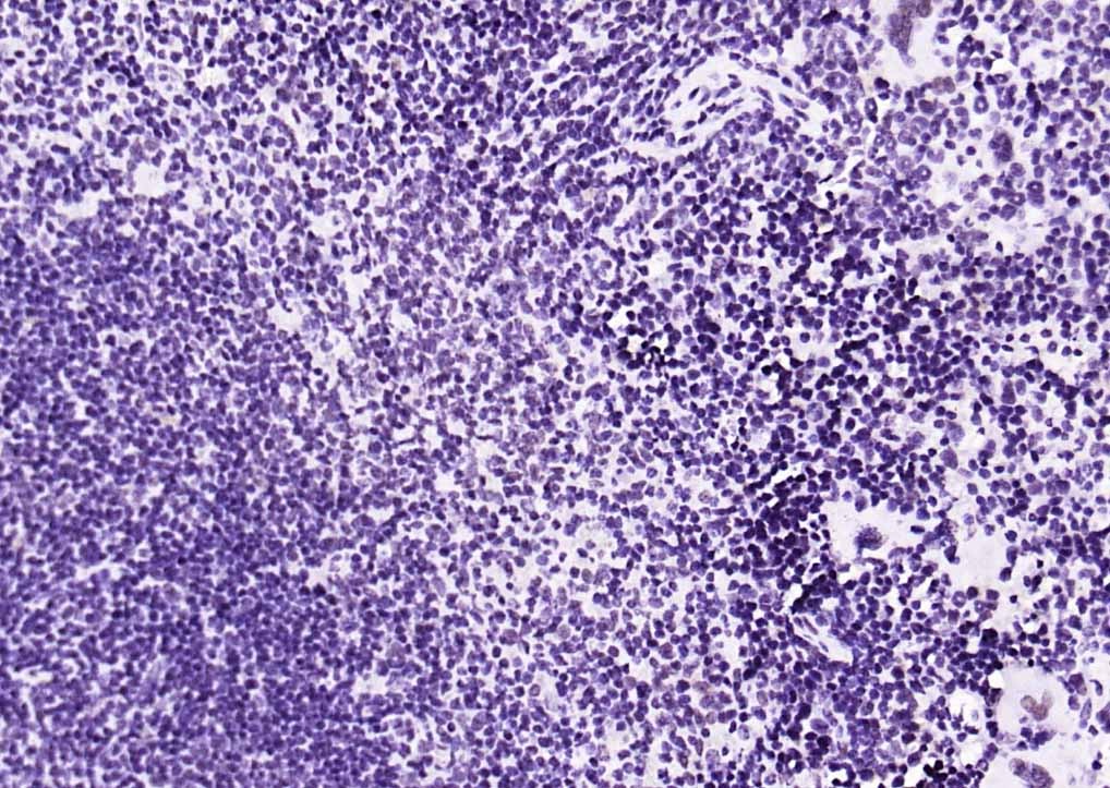 Anti-Phospho-STAT1 (Ser727) Antibody (4T516)