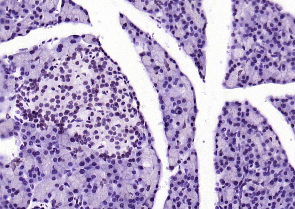 Anti-Phospho-STAT1 (Ser727) Antibody (4T516)