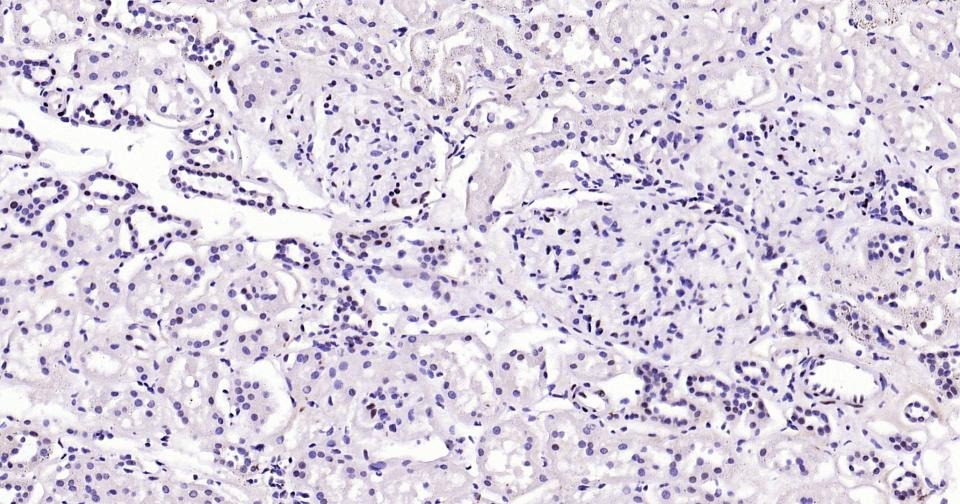 Anti-Phospho-STAT3 (Ser727) Antibody (8J881)
