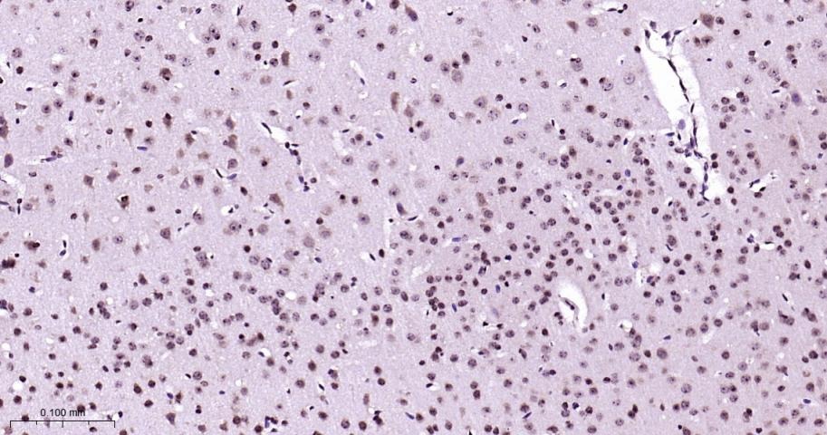 Anti-Phospho-p38 MAPK (Thr180, Tyr182) Polyclonal Antibody