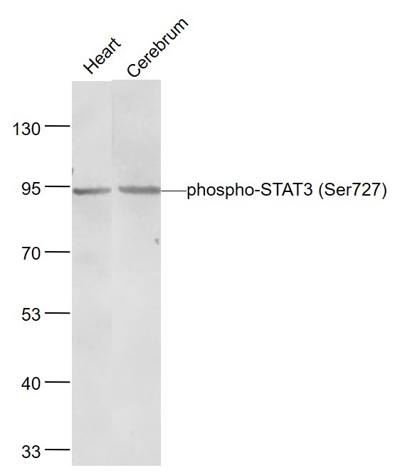 Anti-Phospho-STAT3 (Ser727) Antibody (8J881)