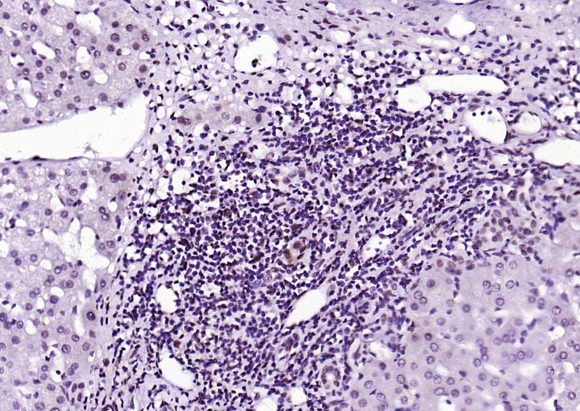 Anti-Phospho-STAT1 (Ser727) Antibody (4T516)