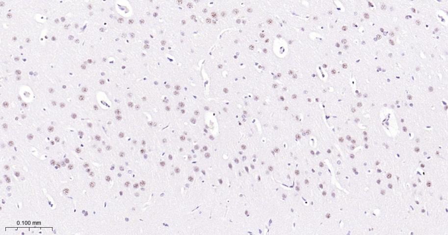 Anti-Phospho-STAT3 (Tyr705) Antibody (2J657)
