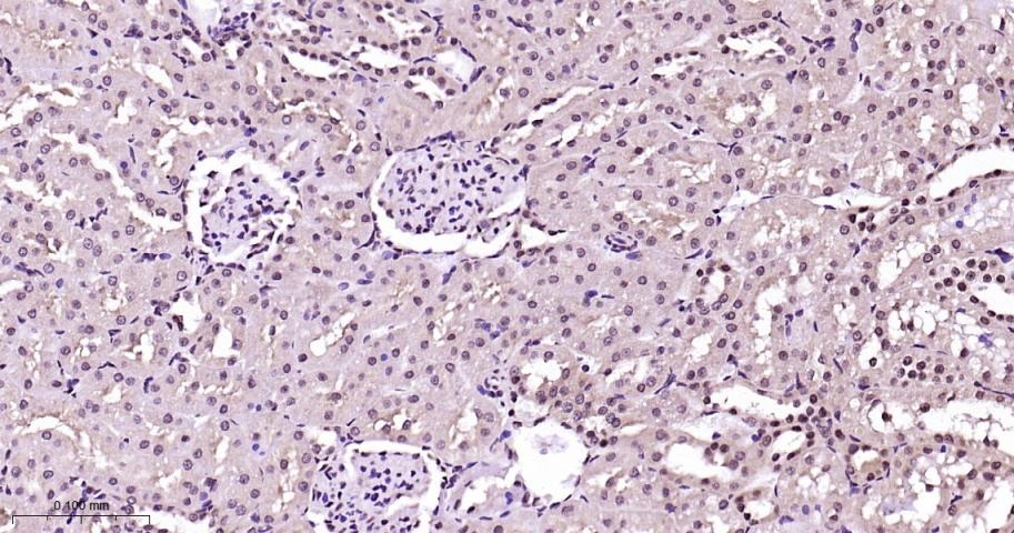 Anti-Phospho-p38 MAPK (Thr180, Tyr182) Polyclonal Antibody