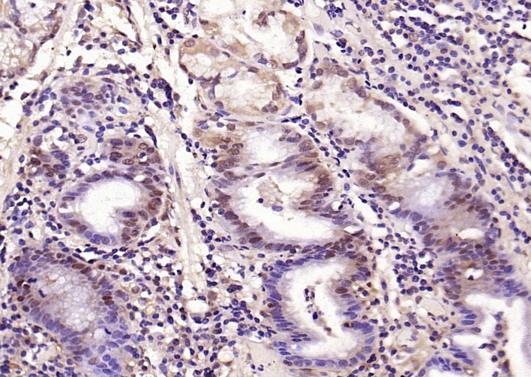 Anti-Phospho-Smad3 (Thr179) Polyclonal Antibody