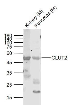 Anti-SLC2A2 Polyclonal Antibody