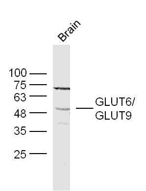 Anti-SLC2A6 Polyclonal Antibody