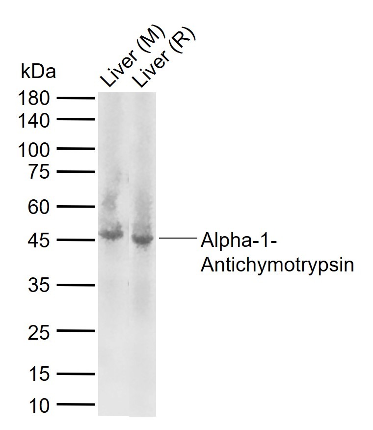 Anti-Serpin A3 Polyclonal Antibody