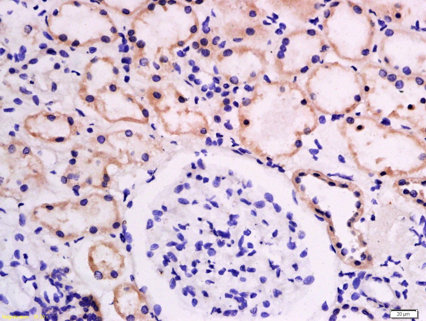 Anti-SLC2A1 Polyclonal Antibody