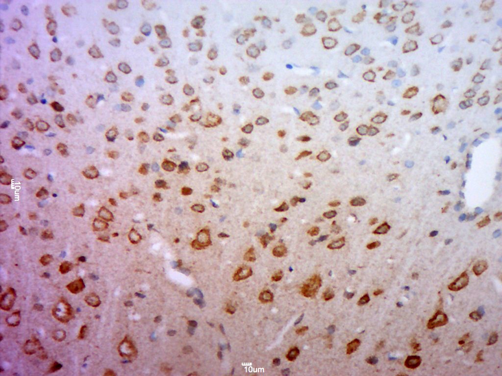 Anti-SLC2A1 Polyclonal Antibody 2