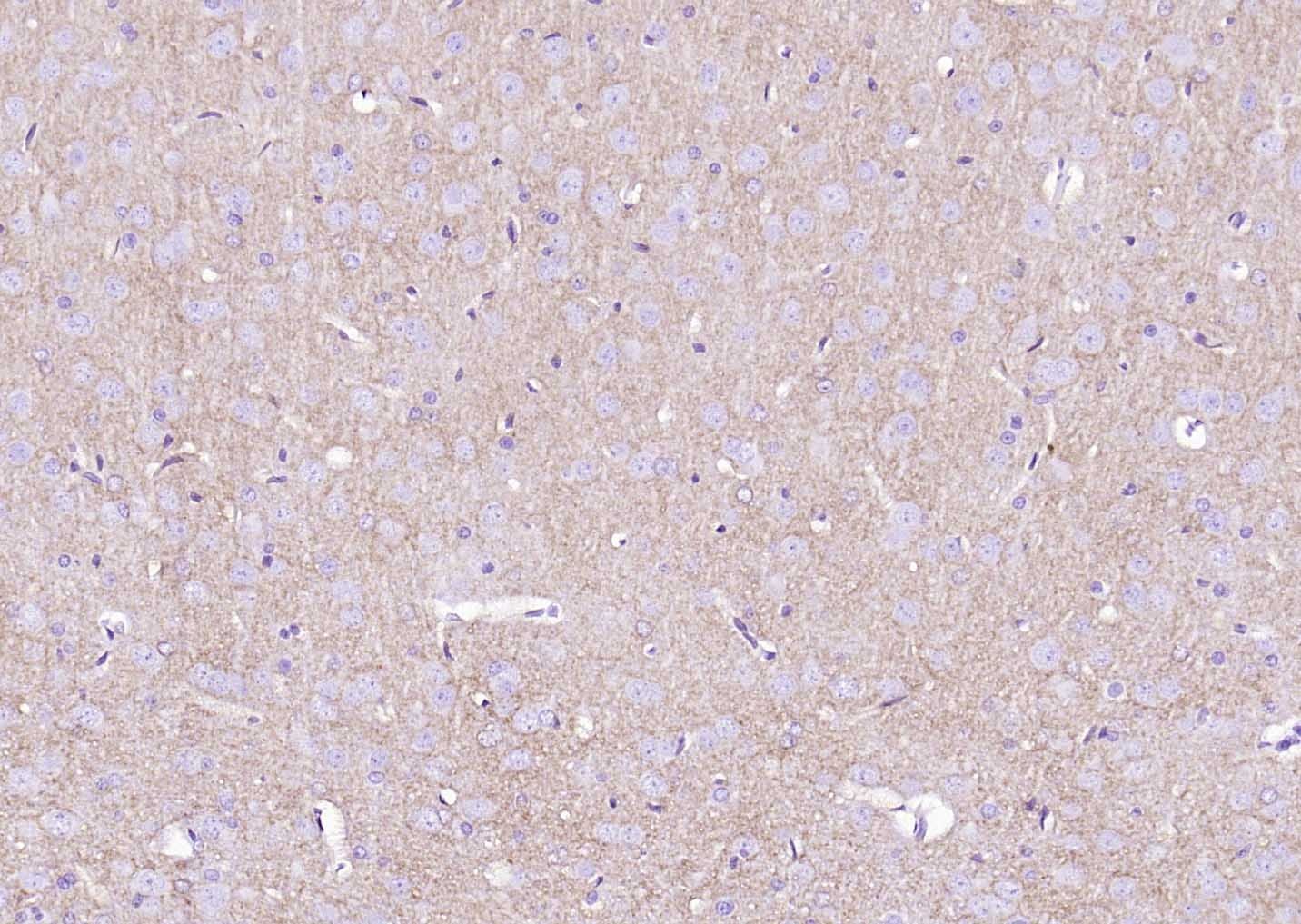 Anti-SLC1A3 Polyclonal Antibody