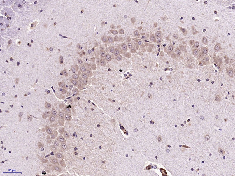 Anti-Serotonin transporter Polyclonal Antibody