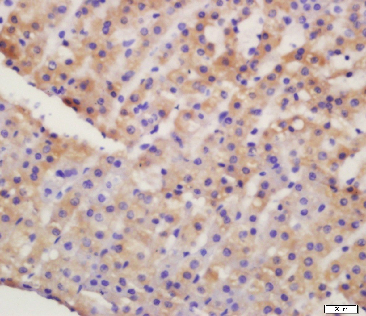 Anti-SLC2A4 Polyclonal Antibody