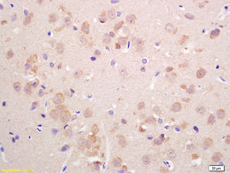 Anti-SLC17A6 Polyclonal Antibody